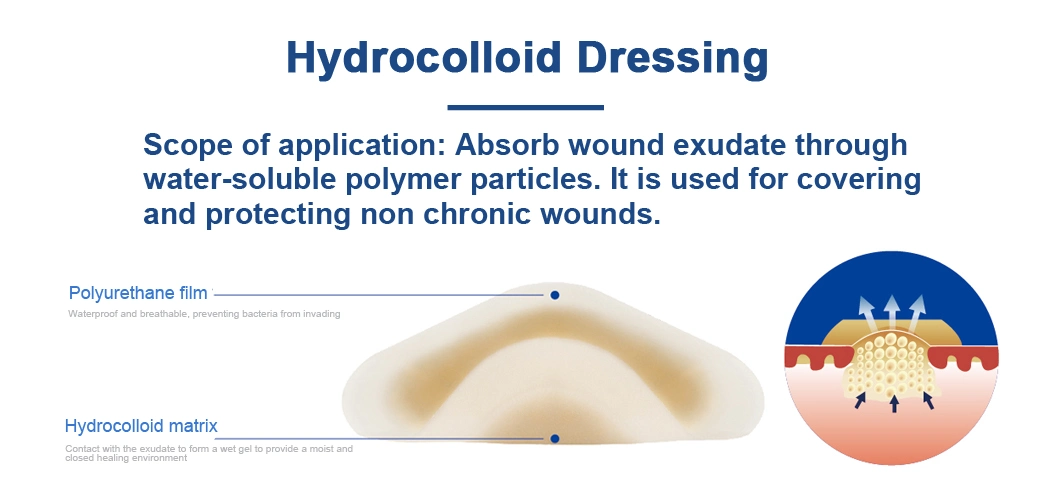 Chinese Factory Medical Wound Thick Hydrocolloid Dressing for Superficial Scratch, Skin Donor Area, Phlebitis