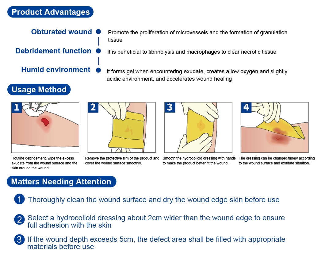 Chinese Factory Medical Wound Thick Hydrocolloid Dressing for Superficial Scratch, Skin Donor Area, Phlebitis